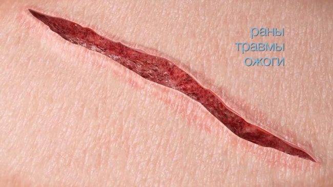 Крем от пятен и шрамов на коже Advanced Bio-Technologies Inc. Kelo-Cote - отзывы