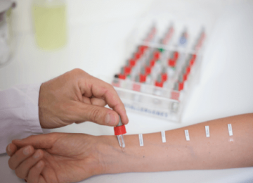 Определить наличие аллергии по анализу крови
