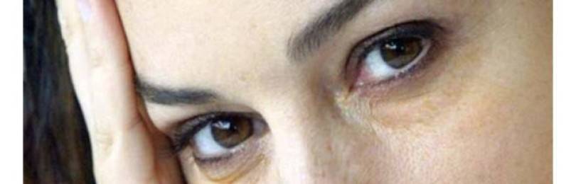 Желтые круги вокруг глаз. причины и лечение