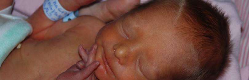 Что такое конъюгационная желтуха у новорожденного?