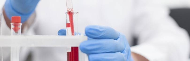 Что такое печеночные трансаминазы в анализе крови?