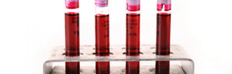 Анализ крови при бронхите: какие показатели общего анализа крови меняются при бронхите