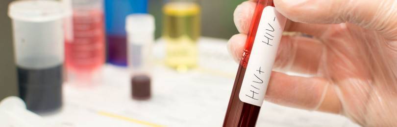Можно ли есть перед сдачей крови на ВИЧ и гепатит?