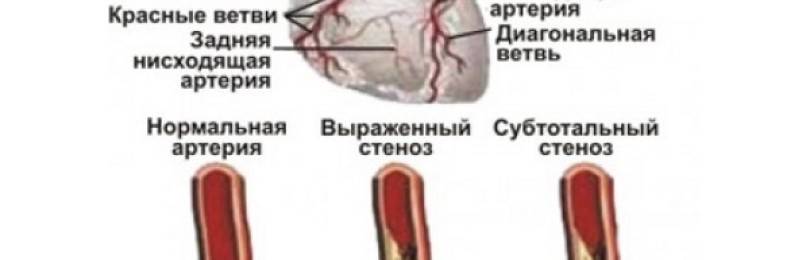 Схема приема кардиомагнила