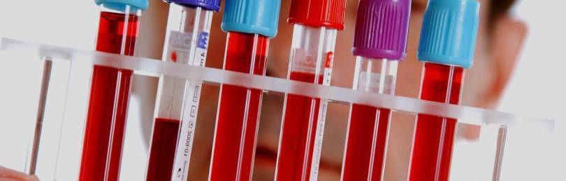 Генетический анализ крови на Синдром Жильбера: тесты и расшифровка