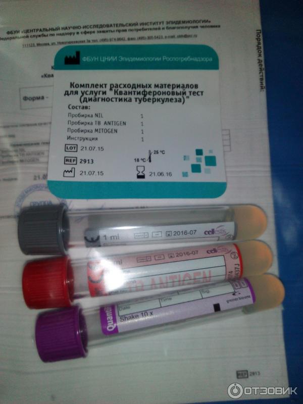 Анализ крови на туберкулез вместо манту: альтернатива вместо реакции ребенку, как называется заменяющий тест