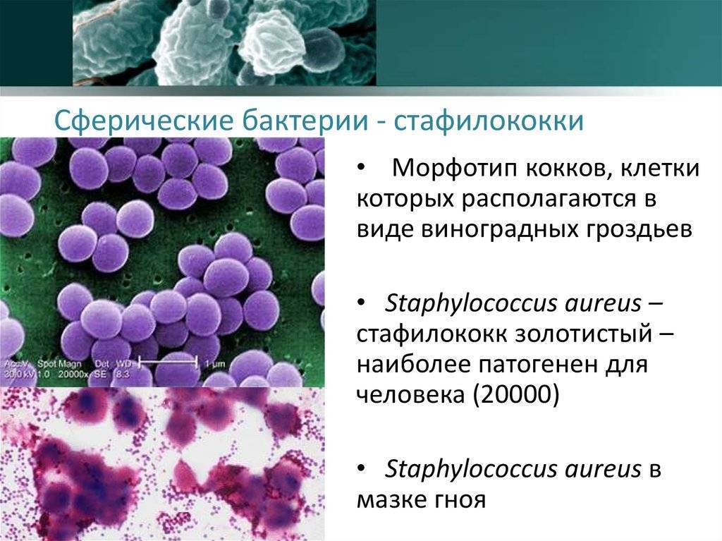 Короче бактерии. Виноградная гроздь грамположительные кокки стафилококки. Бактерии шаровидной формы кокки. S. aureus золотистый стафилококк. Морфотип стафилококк.