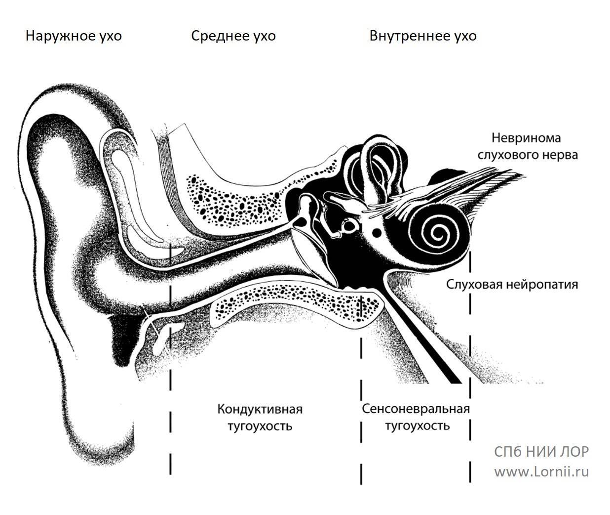 Нарушение внутреннего уха. Нерв внутреннего уха. Строение внутреннего уха человека слуховой нерв. Барабанная перепонка при тугоухости. Строение уха слуховой нерв.