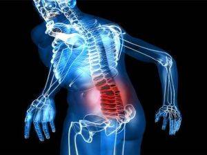 Защемление нерва в крестцовом отделе позвоночника симптомы и лечение