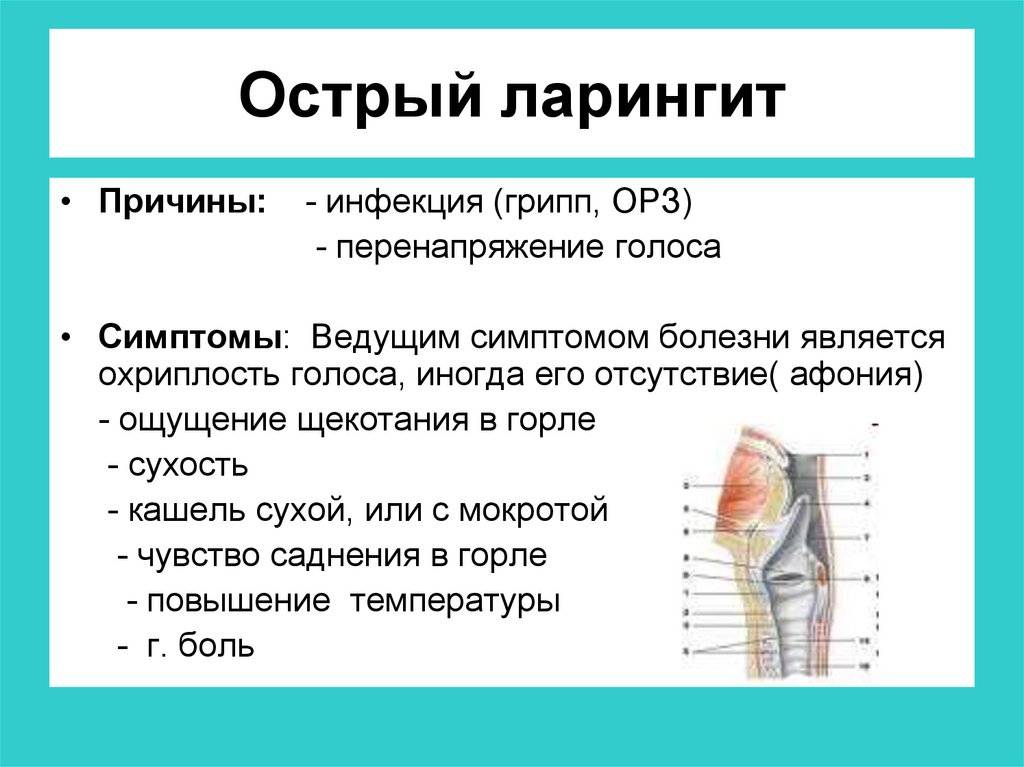 Ларингит схема лечения у детей