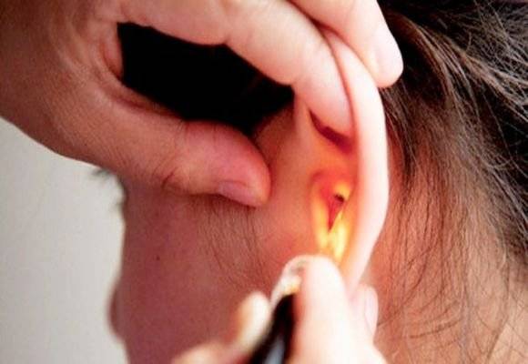 Как вылечить грибковое заболевание ушей (отомикоз)?