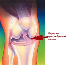 Растяжение связок коленного сустава сроки восстановления