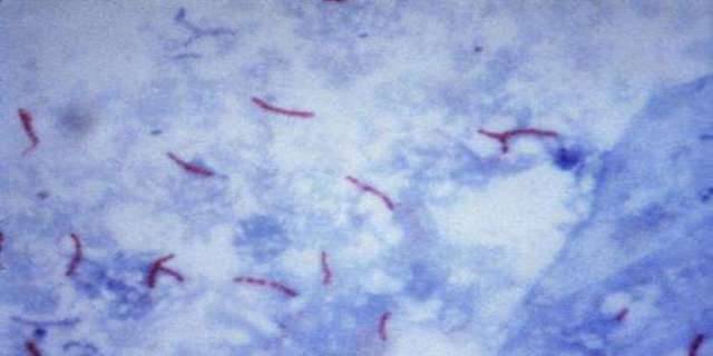 Анализ мокроты на туберкулез: где, как и сколько делается?