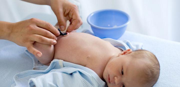 Омфалит у новорожденных (катаральный, гнойный) – симптомы, причины, лечение
