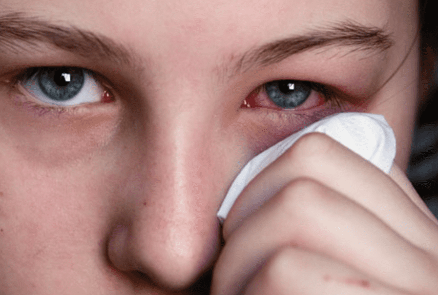 Причины и лечение острого кератита глаза