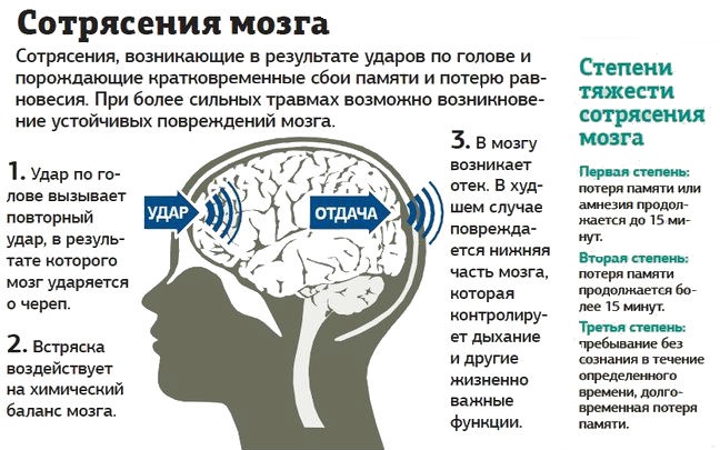 Диагностика сотрясения головного мозга — sportwiki энциклопедия