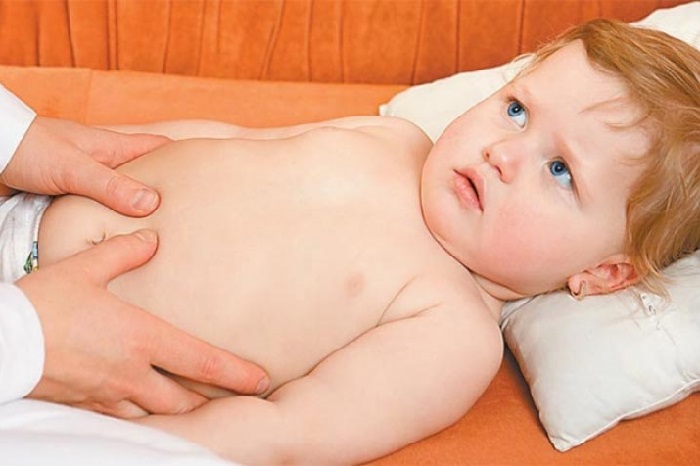Дисплазия соединительной ткани: симптомы и лечение у детей