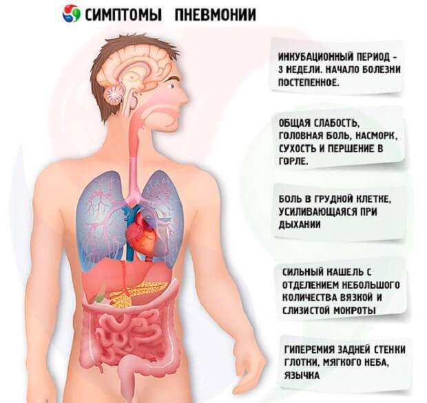 Правосторонняя нижнедолевая пневмония: проверенные методы лечения
