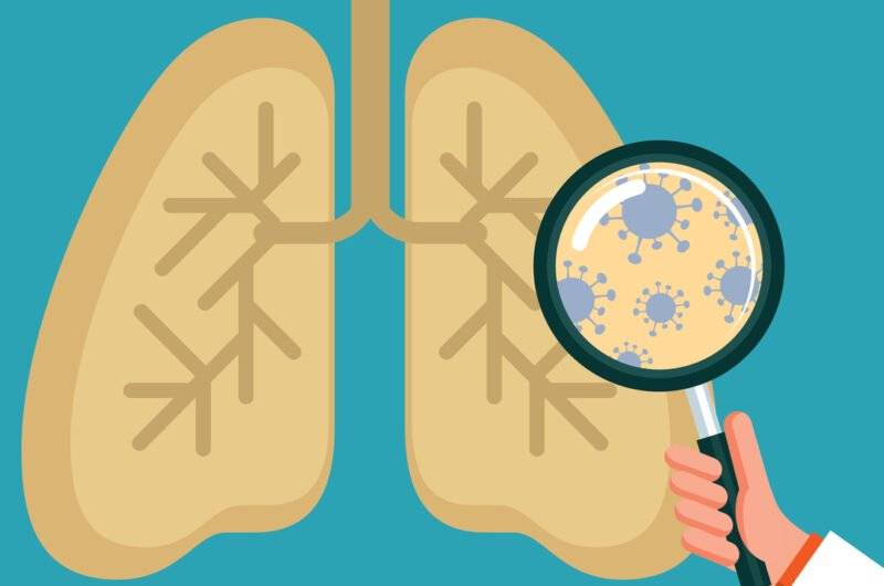 Туберкулез — симптомы и первые признаки, причины, диагностика туберкулёза