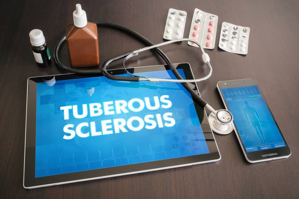 Туберозный склероз у детей симптомы