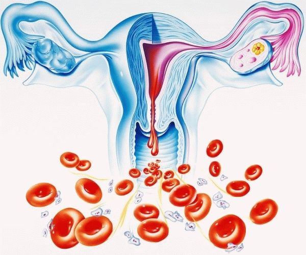 Меноррагия (обильное менструальное кровотечение): причины и методы лечения