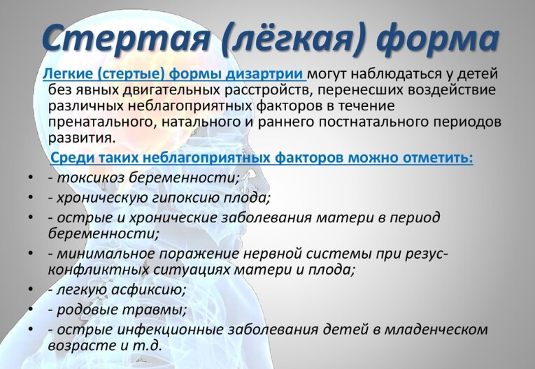 Дизартрия - logopedia.ru