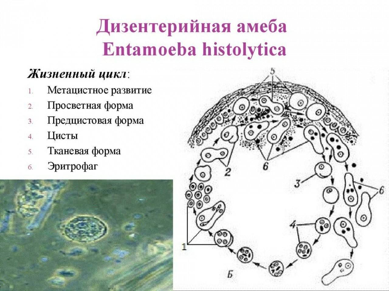 Схема развития амебиаза