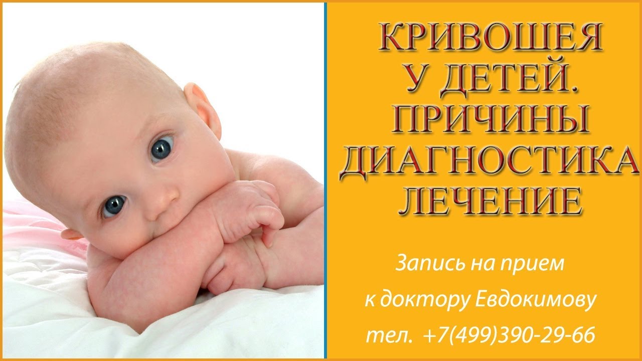 Полезная статья про кривошею - кривошея у новорожденных - запись пользователя надежда (nadya-v-k) в сообществе здоровье новорожденных в категории кривошея - babyblog.ru