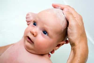 5 причин, почему у новорожденного шелушится кожа