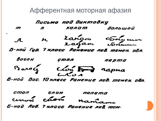 Афферентная афазия. Афферентная моторная афазия. Афферентная моторная афазия зона поражения. Афферентная моторная афазия локализация. Афферентная моторная афазия локализация поражения.