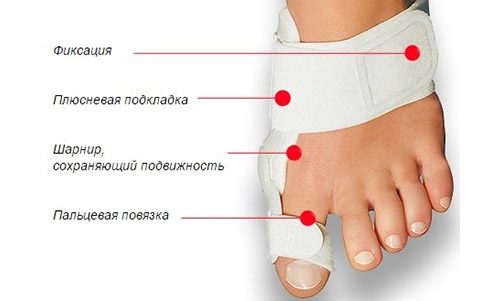 Лечение косточки на большом пальце ноги. Фиксаторы ортопедические для коррекции