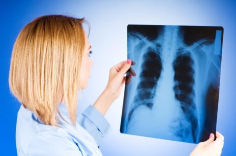 Скрытый туберкулез: какие симптомы и как передается?