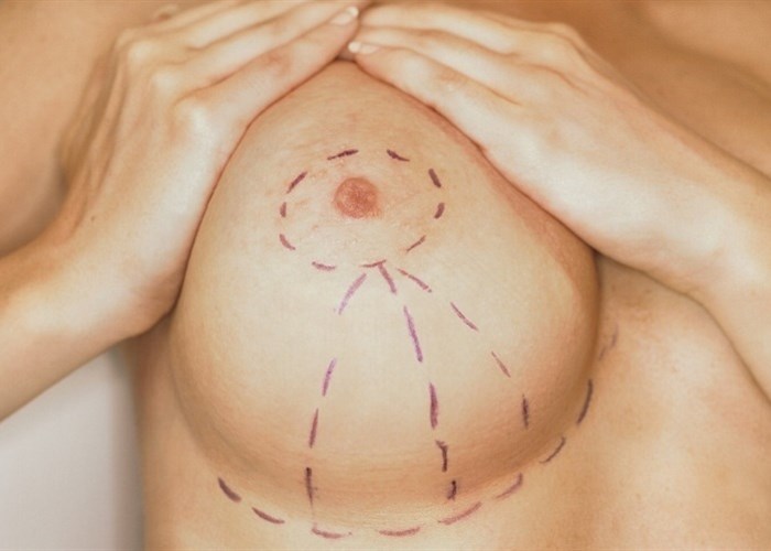 Обвисла грудь после родов: что делать, как подтянуть