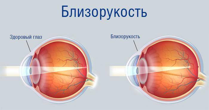 Как проверить остроту зрения в салоне оптики