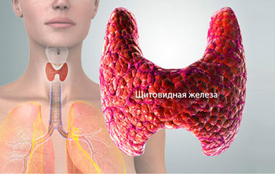 Узловой зоб щитовидной железы - лечение, симптомы, степени тяжести, народные средства в лечении заболевания - docdoc.ru
