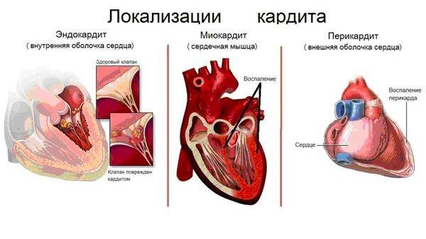 При кашле болит справа под ребрами сбоку что