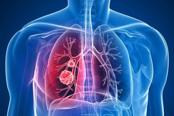 Как курение табака влияет на органы дыхания и какие заболевания дыхательной системы вызывает?