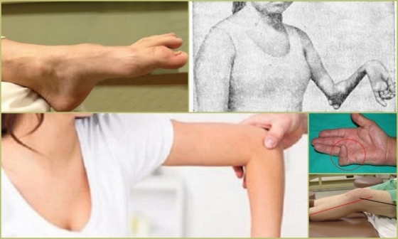 Артрит голеностопа: характерные признаки и лечение, фото симптомов