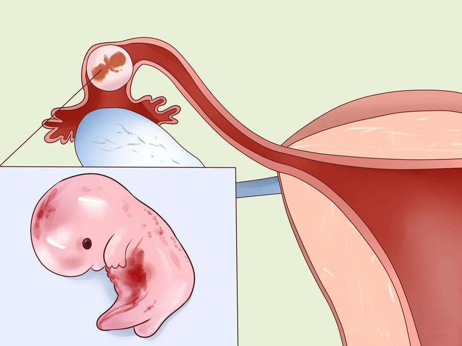 Внематочная беременность: первые признаки, последствия, что делать?
