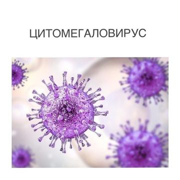 Цитомегаловирус: описание вируса и болезни