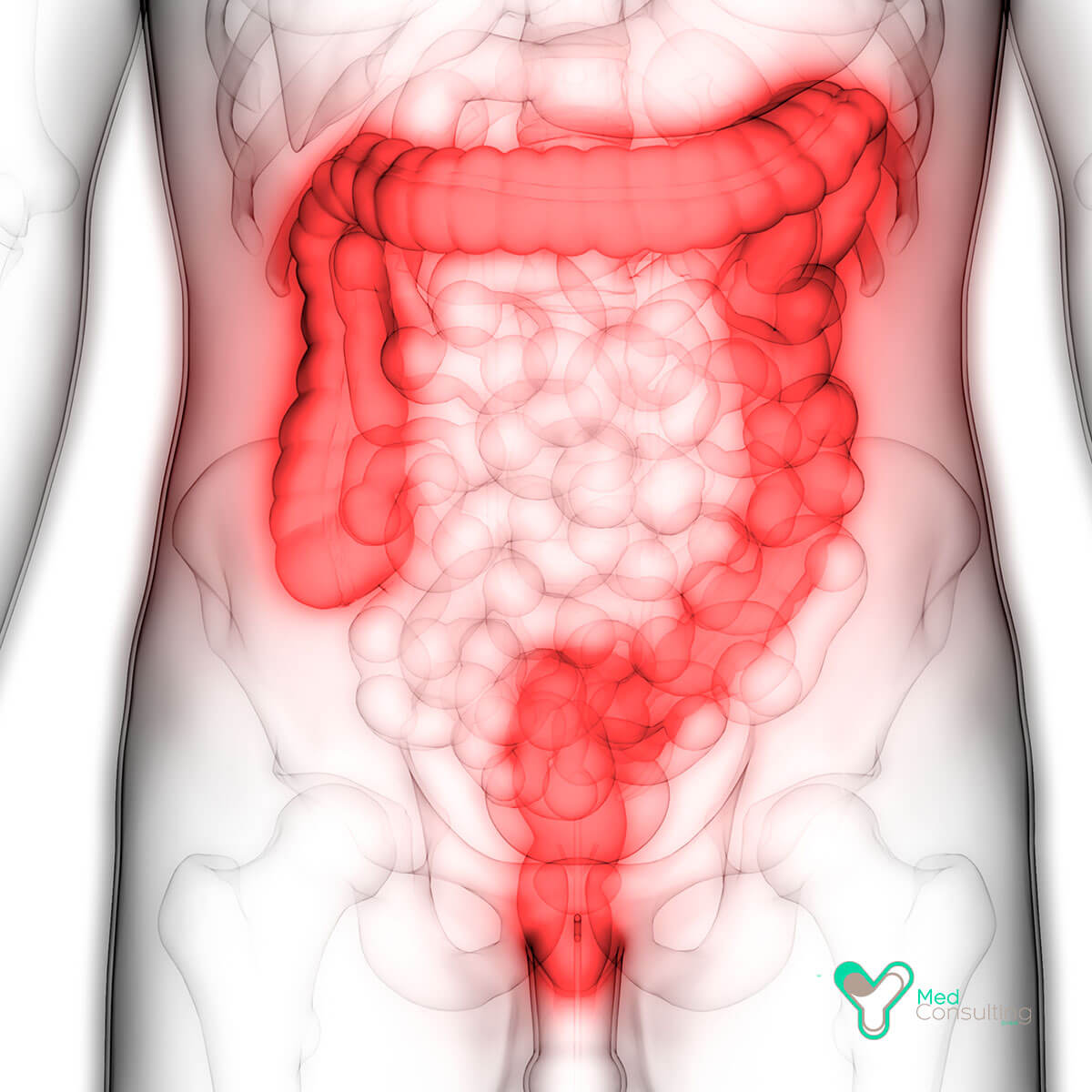 Язва желудка — симптомы, причины, диета и лечение язвы желудка