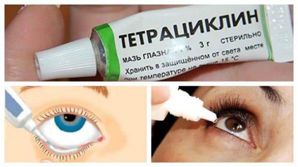 Тетрациклиновая мазь можно ли грудничкам мазать глаза тетрациклиновой мазью: в каких случаях применять и противопоказания