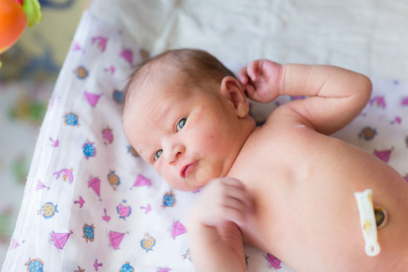 Лечение мокнущего пупка у новорожденного