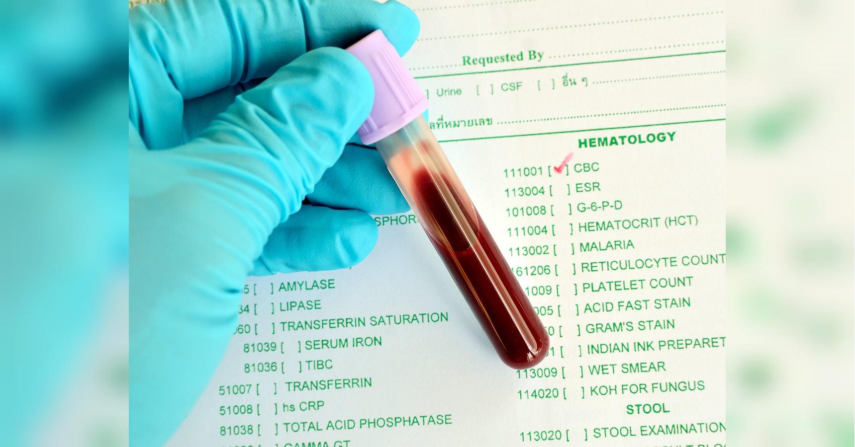 Анализ соэ крови: норма и расшифровка результатов