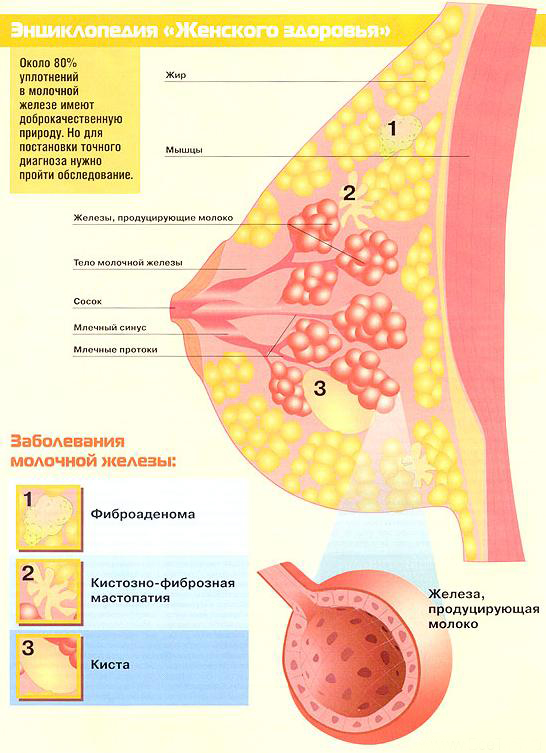 Жировые дольки в груди - запись пользователя наташа (evgeniidiana2017) в сообществе семейное здоровье в категории маммология (молочная железа) - babyblog.ru