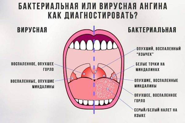 Оки как полоскать горло