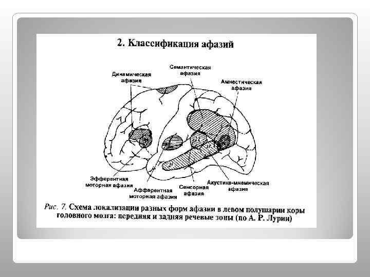 Афферентная кинестетическая моторная афазия