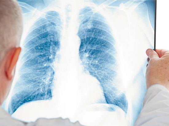 Туберкулёз на рентгене: особенности диагностики