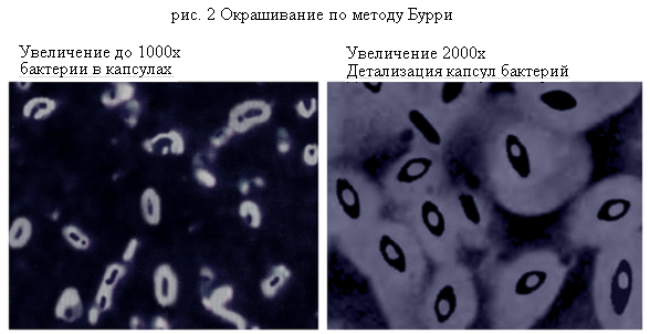 Гинса окраска. Метод Бурри Гинса. Метод по Бурри ГИНСУ микробиология. Капсула бактерий окраска по Бурри-ГИНСУ. Окраска капсул по Бурри-ГИНСУ.