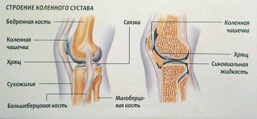 Лечение повреждения внутреннего мениска коленного сустава